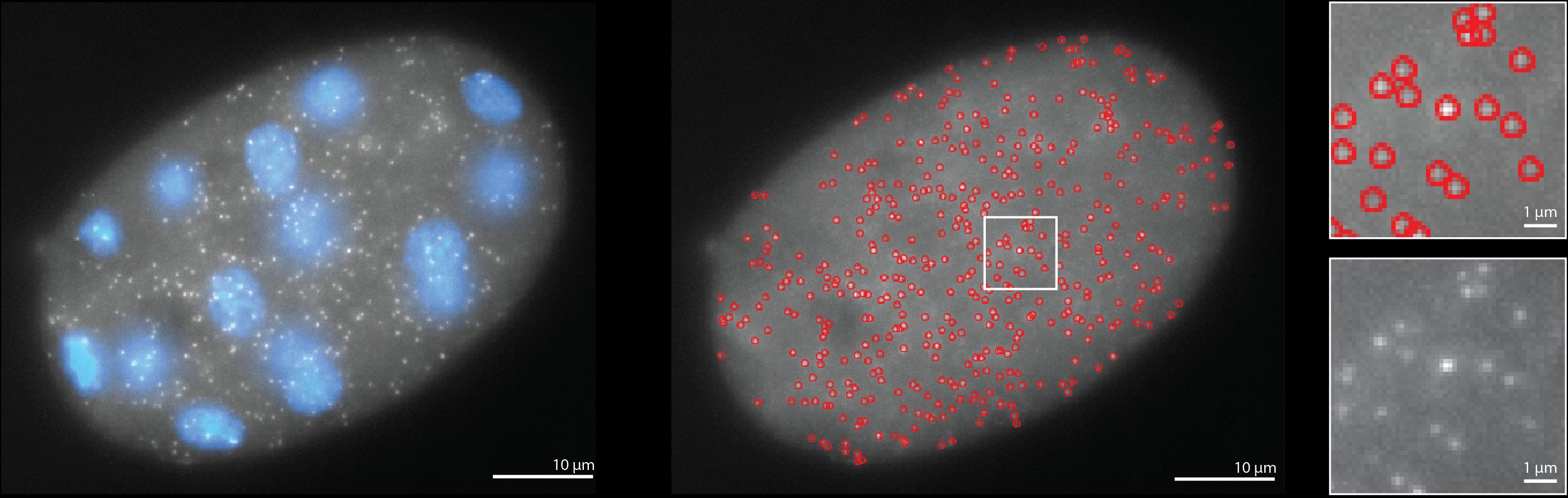 Embryo with RS-FISH detected smFISH spots